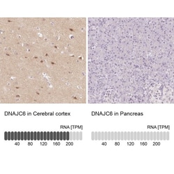 DNAJC6 Antibody, Novus Biologicals 25 &mu;L, Unlabeled:Antibodies, Polyclonal
